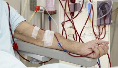 Global Hemodialysis Market 2023 | Size and Forecast 2023-2028